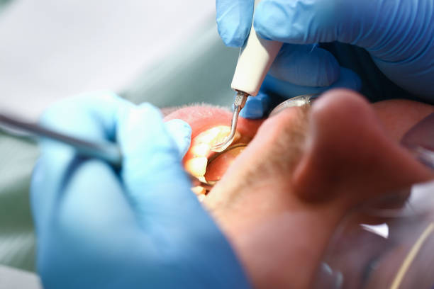Best Weekend Emergency Dental Services in Channahon, IL