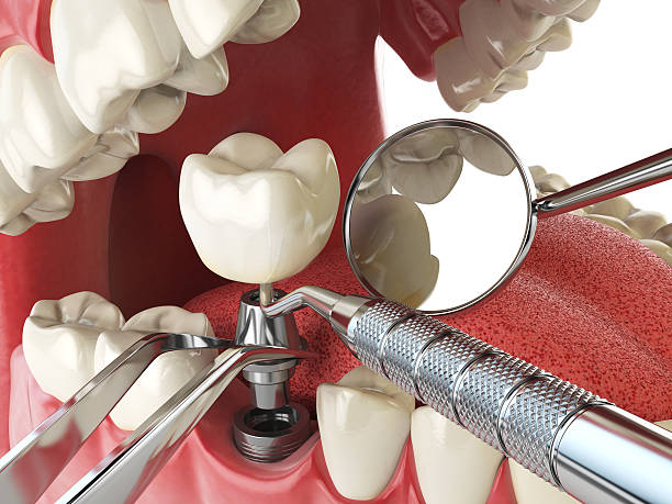 Best Emergency Care for Gum Disease in Channahon, IL